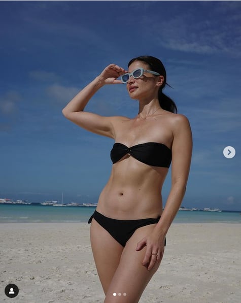 ANNE Curtis